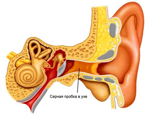 bolezni uha2