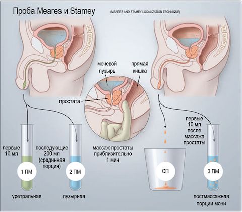 Анализ секрета простаты