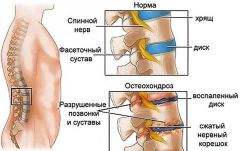 Массаж позвоночника