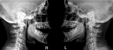 rentgen sustavov chelyusti2