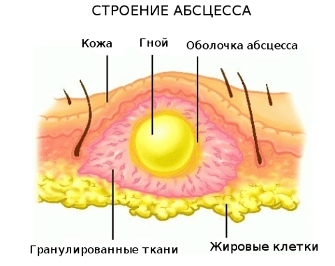 Строение гнойно-воспалительного образования