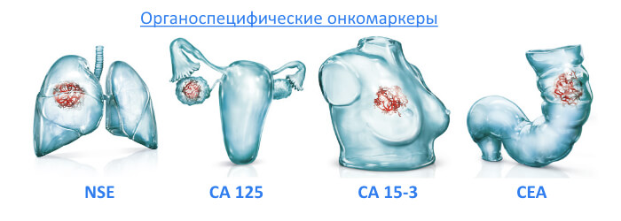 Определение маркеров опухолевых заболеваний (онкомаркеры)