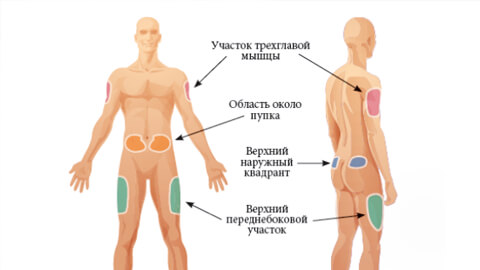 подкожная инъекция