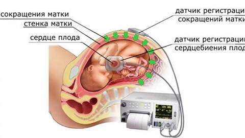 ктг плода