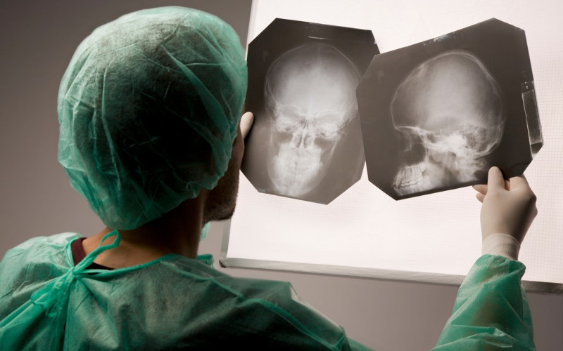Рентген черепа