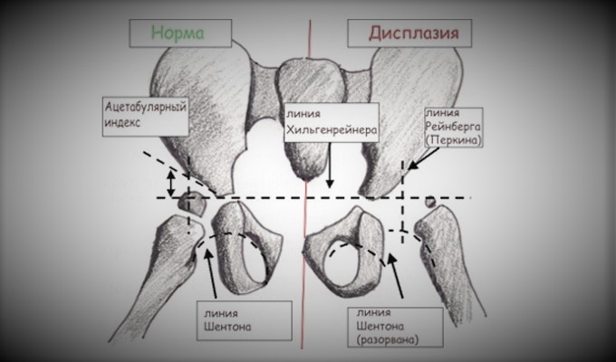 Рентген суставов