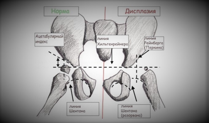 Рентген суставов