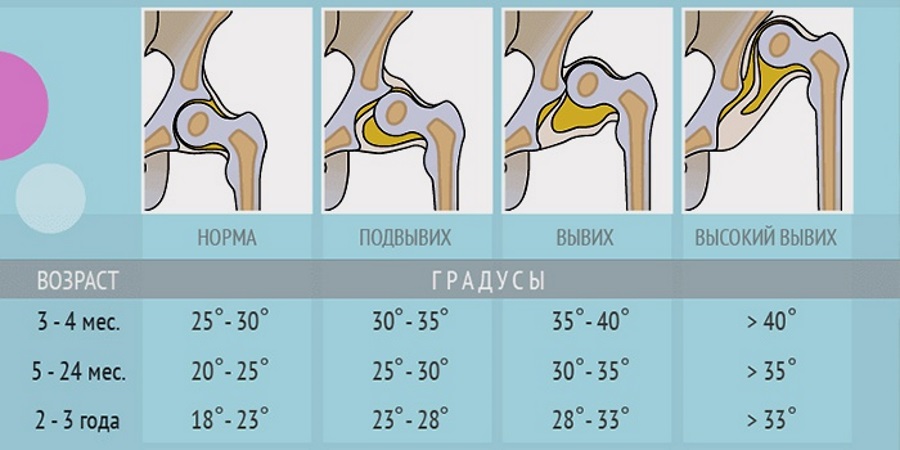 Рентген суставов