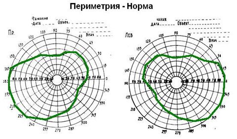 периметрия глаза