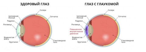 Внутриглазное давление