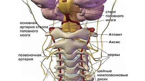 Шейный остеохондроз