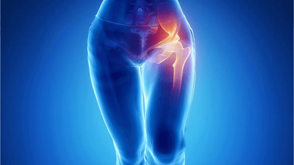 Что такое остеосинтез при переломах лучевой кости thumbnail