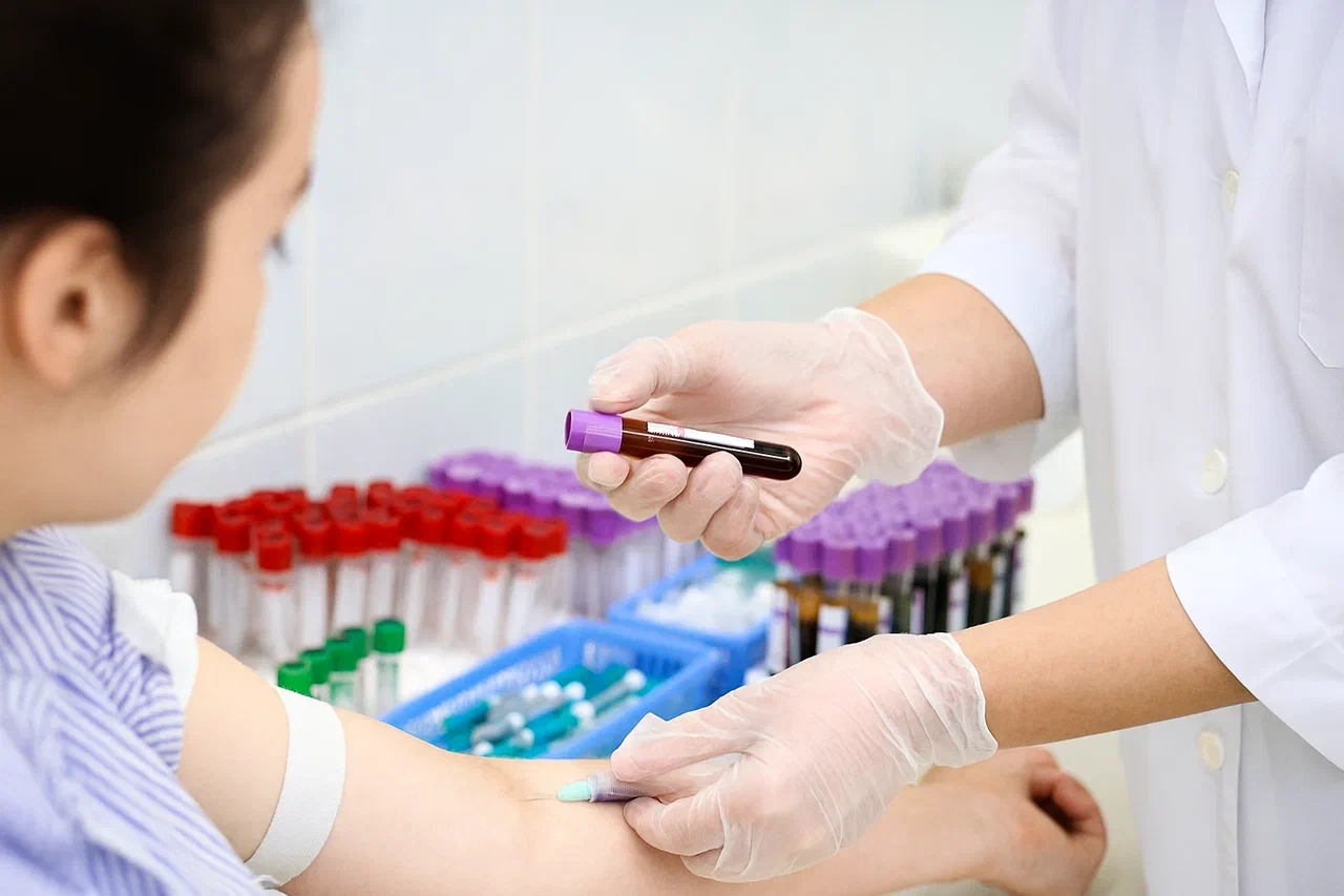 В каких случаях назначают общий анализ крови В каких случаях назначают общий анализ крови